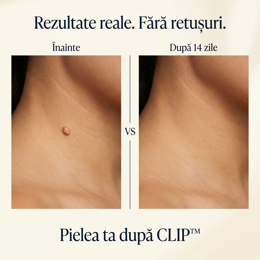 CLIP